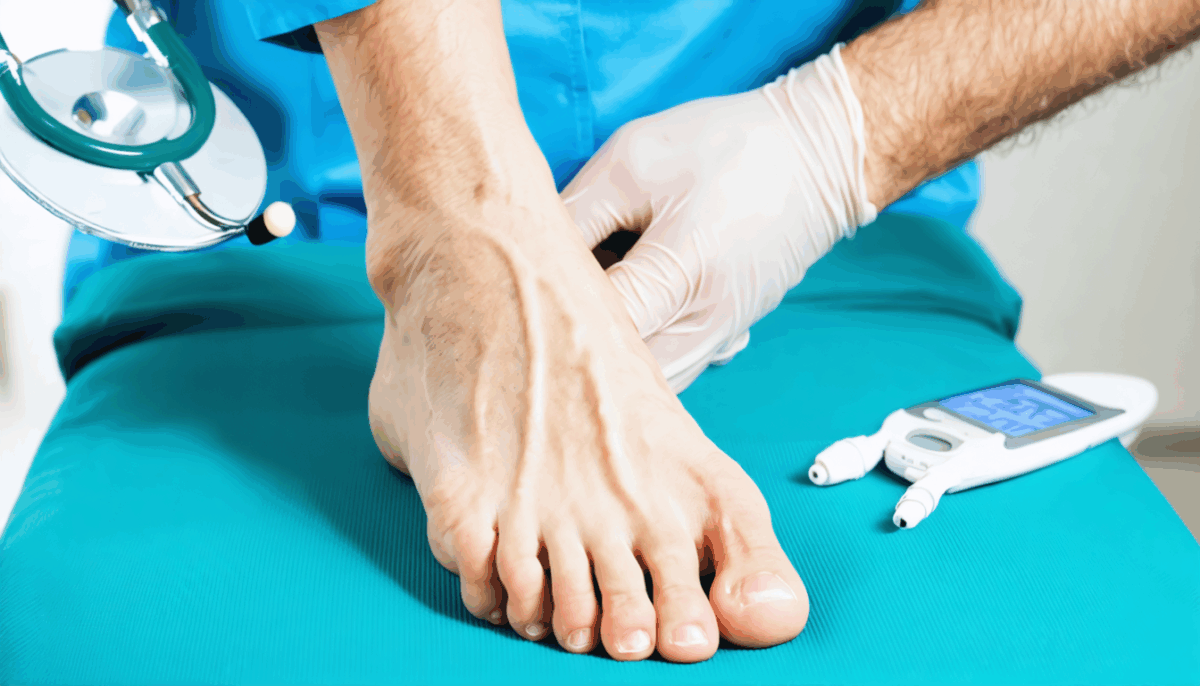 découvrez les causes du pied diabétique et apprenez les meilleures stratégies pour prévenir cette complication sérieuse du diabète, afin de protéger votre santé et améliorer votre qualité de vie.